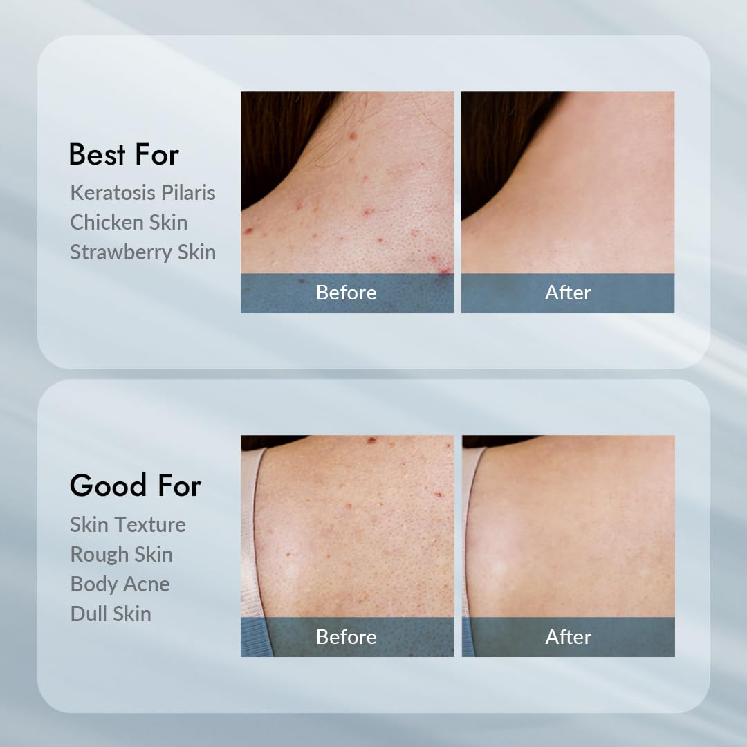 V11FACTORY AHA Loción corporal con 12% de ácido glicólico, crema corporal exfoliante e hidratante coreana con ácido hialurónico y colágeno, sin perfume, hidratante suavizante de la piel sin parabenos