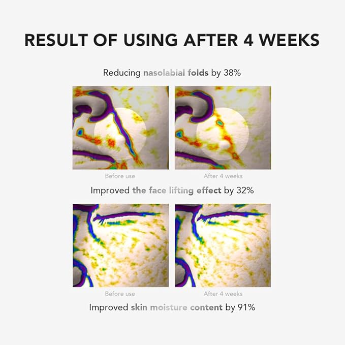 Crema de rodillo de elevación de retinol con aplicador de masaje, crema vegana antienvejecimiento para cara y cuello para reducir las arrugas y la línea fina, para cara, cuello, cuidado de