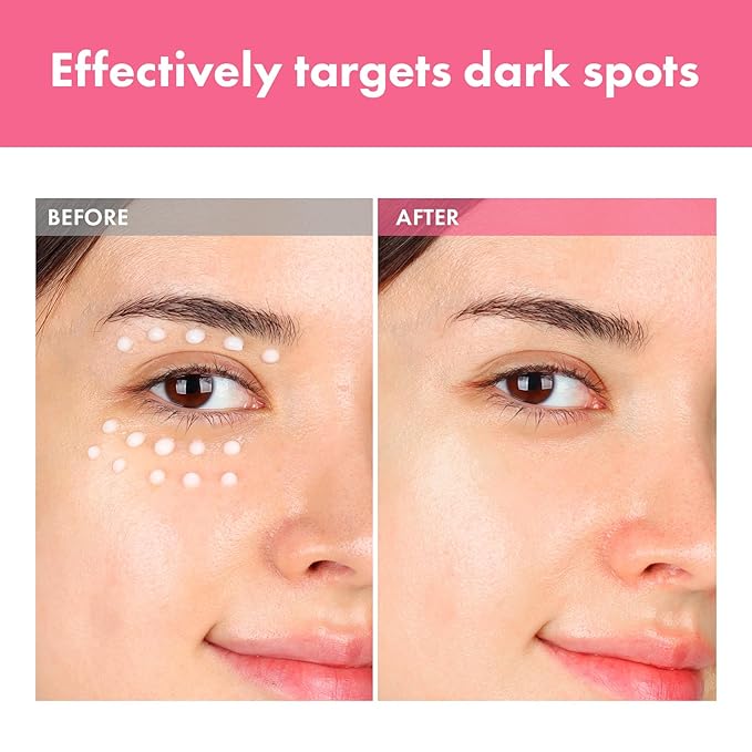 Arbutin 7% Crema intensiva para manchas con 70,000 ppm de arbutina, 3% ácido tranexámico, 1% niacinamida, glutatión, manchas oscuras, pecas, manchas, antipigmentación