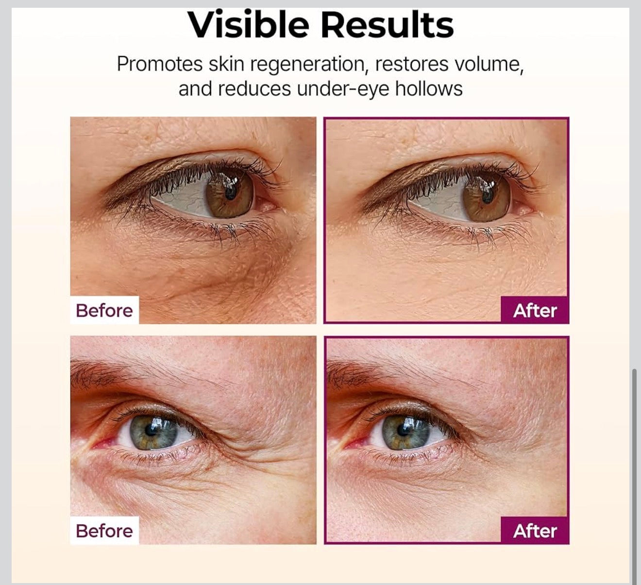 Dr.Melaxin Cemenrete Calcio Multi Bálsamo 9g Cuidado de la Piel Coreano Todo en Uno Calcio Stick Colágeno Arrugas Tratamiento Facial y de Ojos Bálsamo