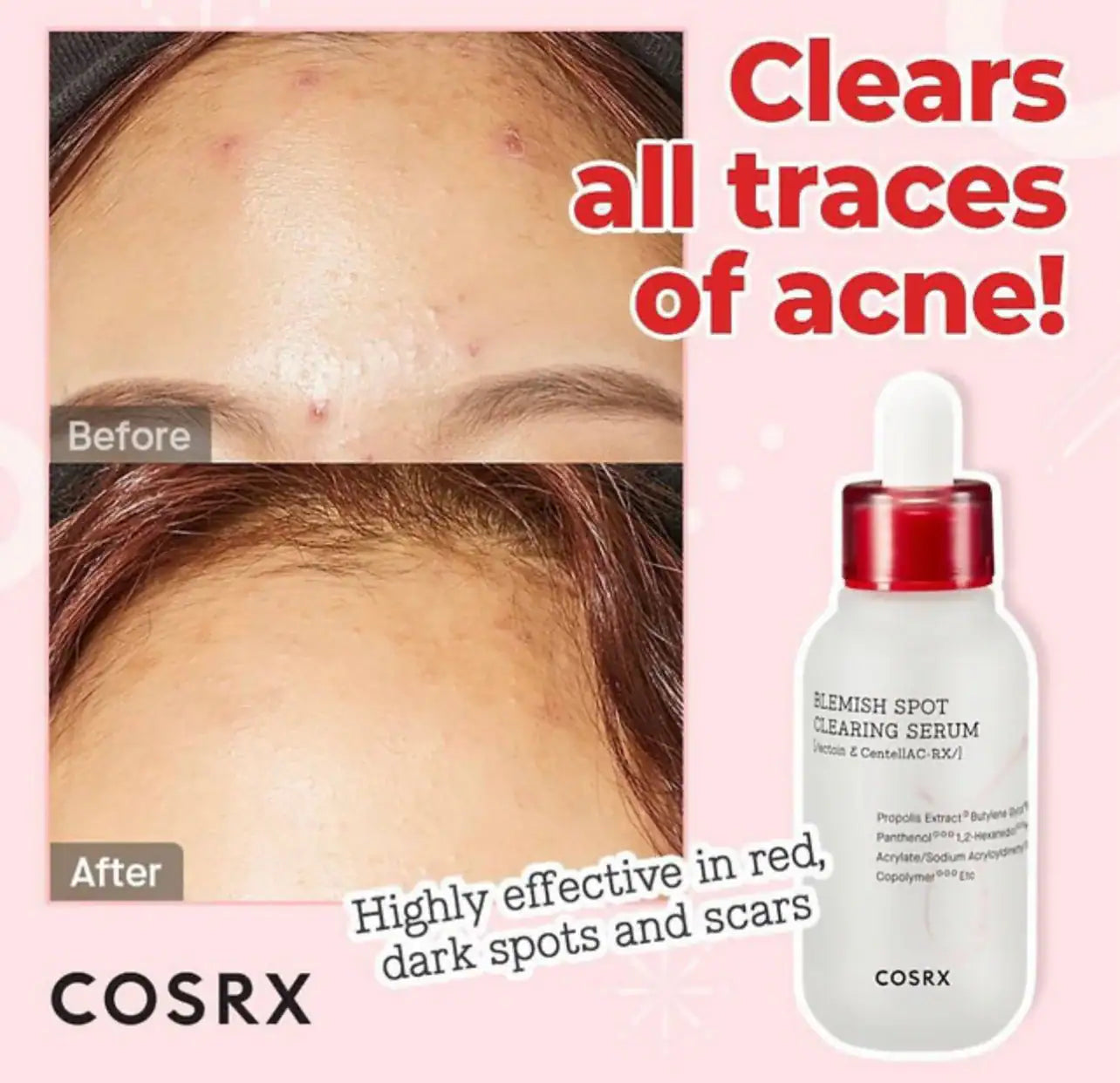 COSRX AC Collection - Suero para limpiar manchas de manchas, 1.4 fl oz / 1.35 onzas líquidas | Centella, niacinamida, suero EGF | Sin crueldad, sin parabenos, cuidado de la piel coreano
