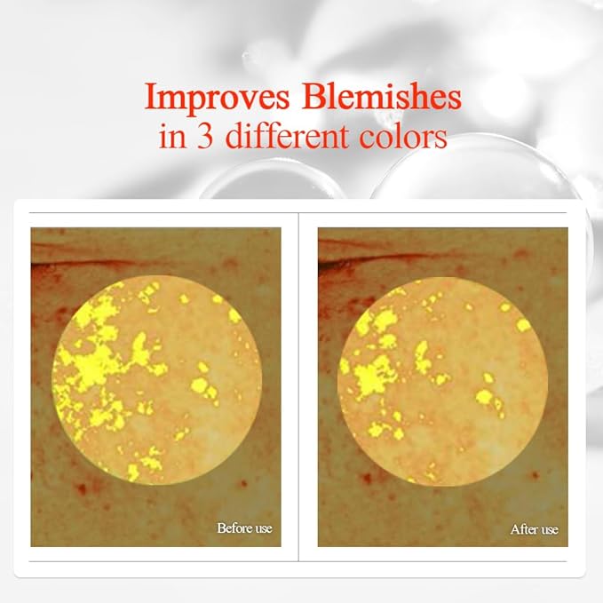 Tóner Radiance Vita para piel impecable y radiante, tóner para el cuidado de imperfecciones con vitamina C y niacinamida, cero irritación, cuidado de la piel coreano