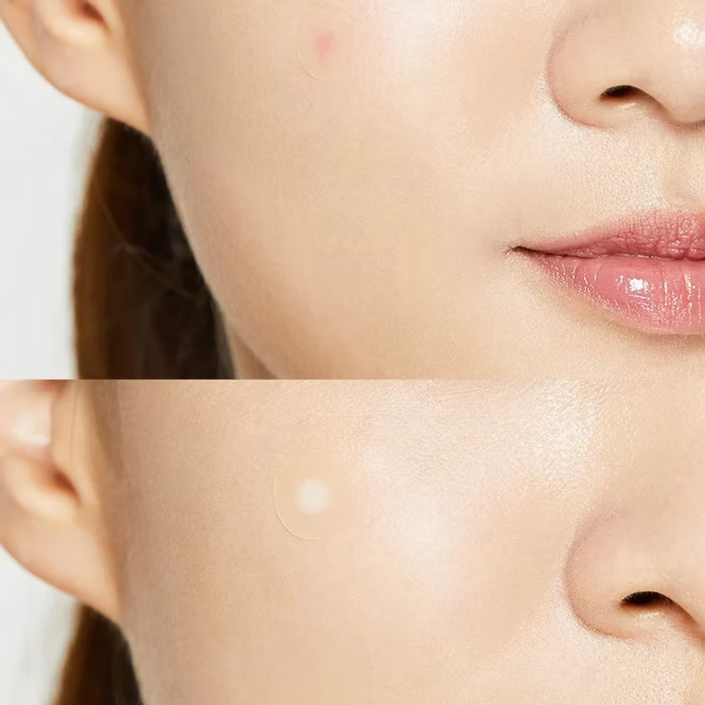 COSRX - Acne Pimple Master Patch 24und