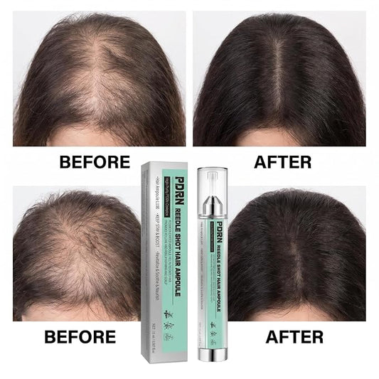 PDRN Reedle Shot - Ampolla para el cabello L100, PDRN Complejo cuero cabelludo apoyo para la salud del cuero cabelludo, uso doméstico para el volumen del cabello y apoyo al crecimiento, suero